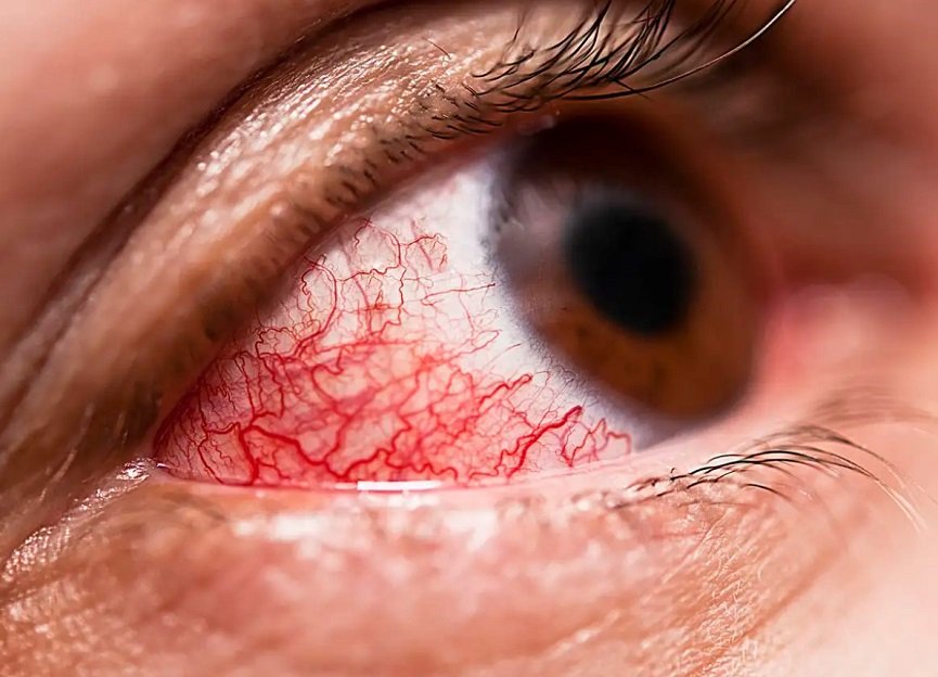 Diabetic Eye Disease Specialist